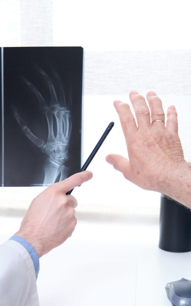 Doctor going over x-ray with patient who has arthritis in hands