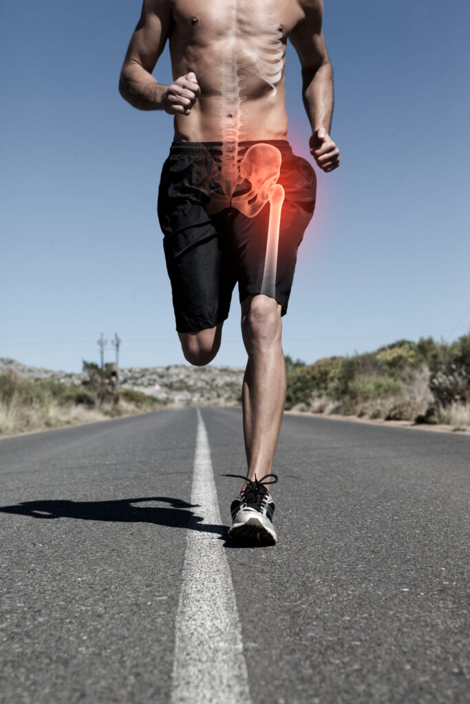 Man running with hip pain