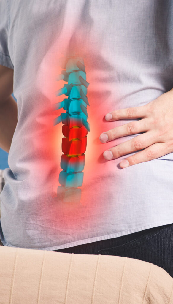 Man on couch with xray view of spine with red for herniated disc