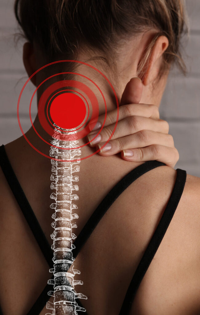 Back view of woman with red for area affected by whiplash